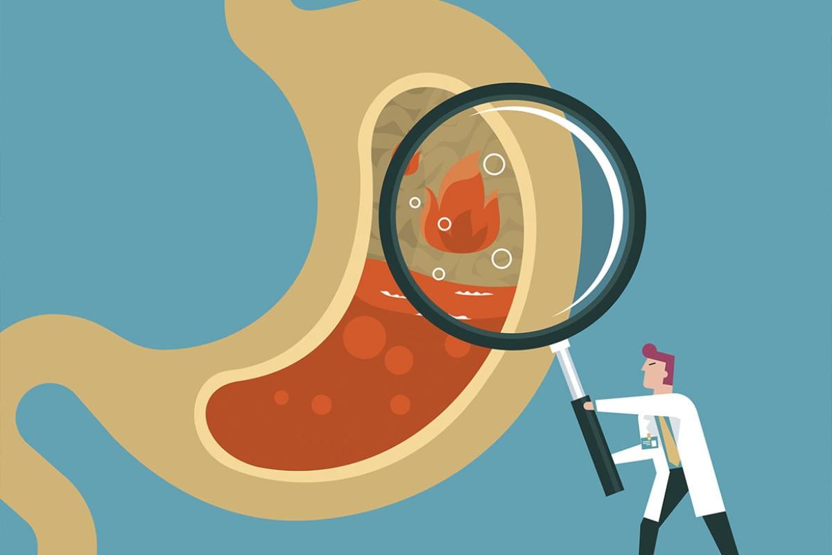 Doctor holding large magnifying glass over stomach heartburn