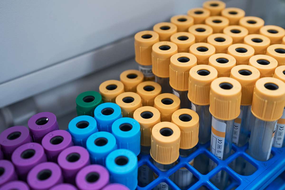 Samples in test tube rack at laboratory